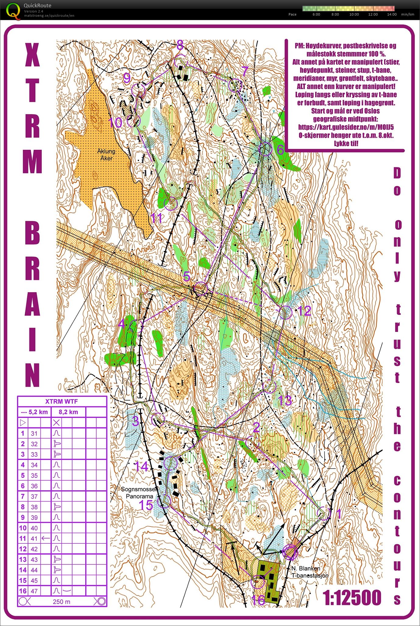 XTRM brain (26.09.2017)