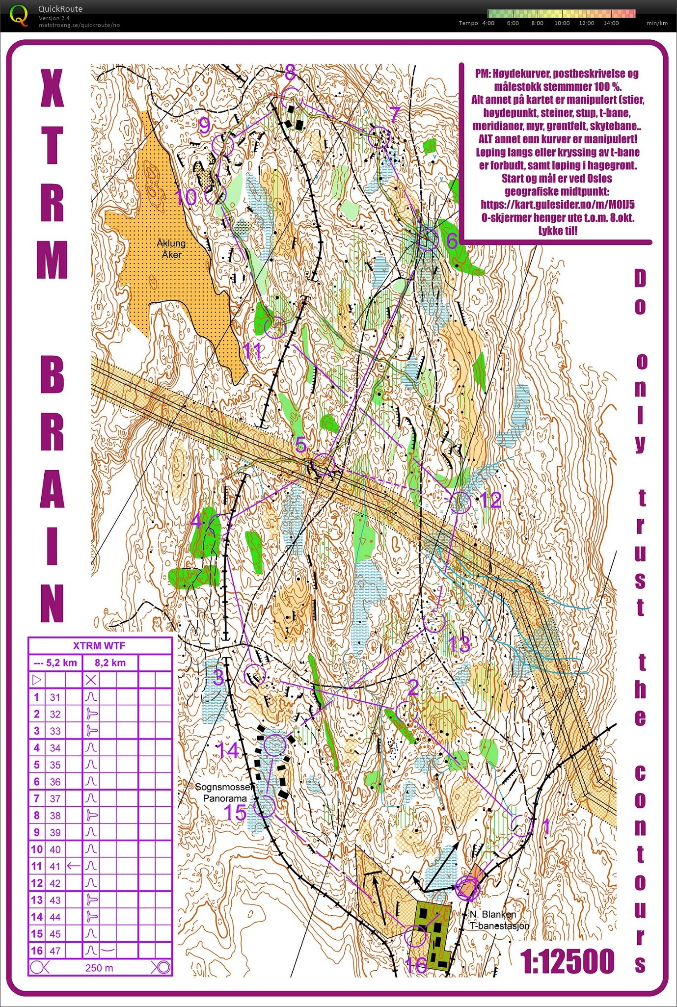 XTRM Brain 2.0 (12.10.2017)