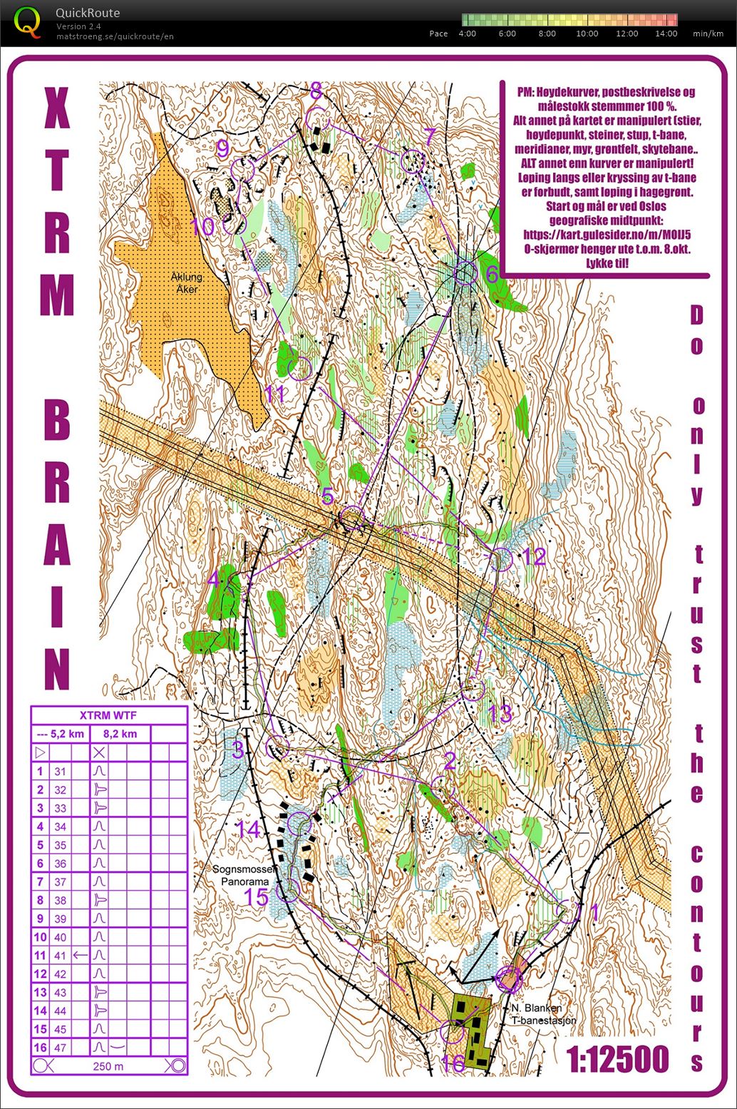 XTRM Brain  (30.03.2020)